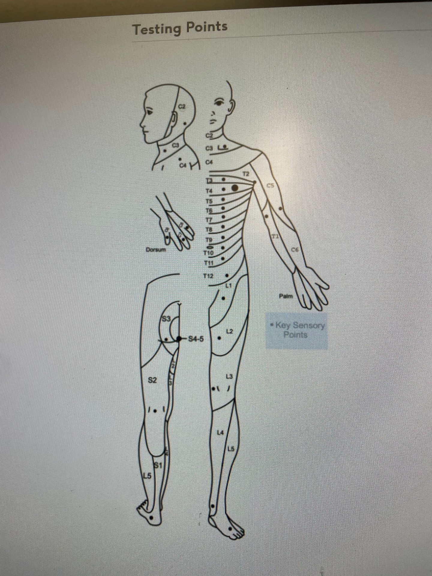 <p>C2- 3cm behind ear</p><p>C3- supraclavicular fossa</p><p>C4- AC joint</p><p>C5- anterolateral elbow</p><p>C6- dorsal thumb</p><p>C7- dorsal middle finger</p><p>C8- dorsal little finger</p><p></p><p>T1- anteromedial elbow</p><p>T2- axilla</p><p>T3- 3rd intercostal space</p><p>T4- level of nipples</p><p>T5- xiphoid→ sternum upper</p><p>T6- xiphoid → sternum lower</p><p>T7- quarter way to umbilicus</p><p>T8- half-way to umbilicus</p><p>T9- three-quarter way to umbilicus</p><p>T10- umbilicus</p><p>T11- between umbilicus and inguinal ligament</p><p>T12- inguinal ligament</p><p></p><p>L1- proximal thigh</p><p>L2- anteromedial thigh</p><p>L3- medial femoral condyle</p><p>L4- medial malleolus</p><p>L5- dorsal 3rd metacarpal</p><p></p><p>S1- lateral calcaneus</p><p>S2- popliteal fossa</p><p>S3- ischial tuberosity</p><p>S4/5- next to asshole</p><p>^ to be done for a spinal cord injury</p>