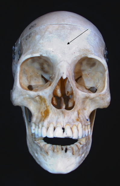 name the bone 