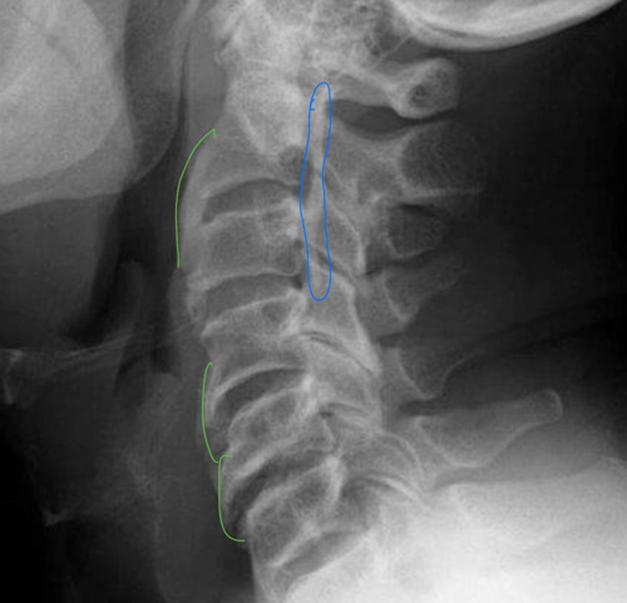 <p>What is the green?</p><p>What is the blue?</p>