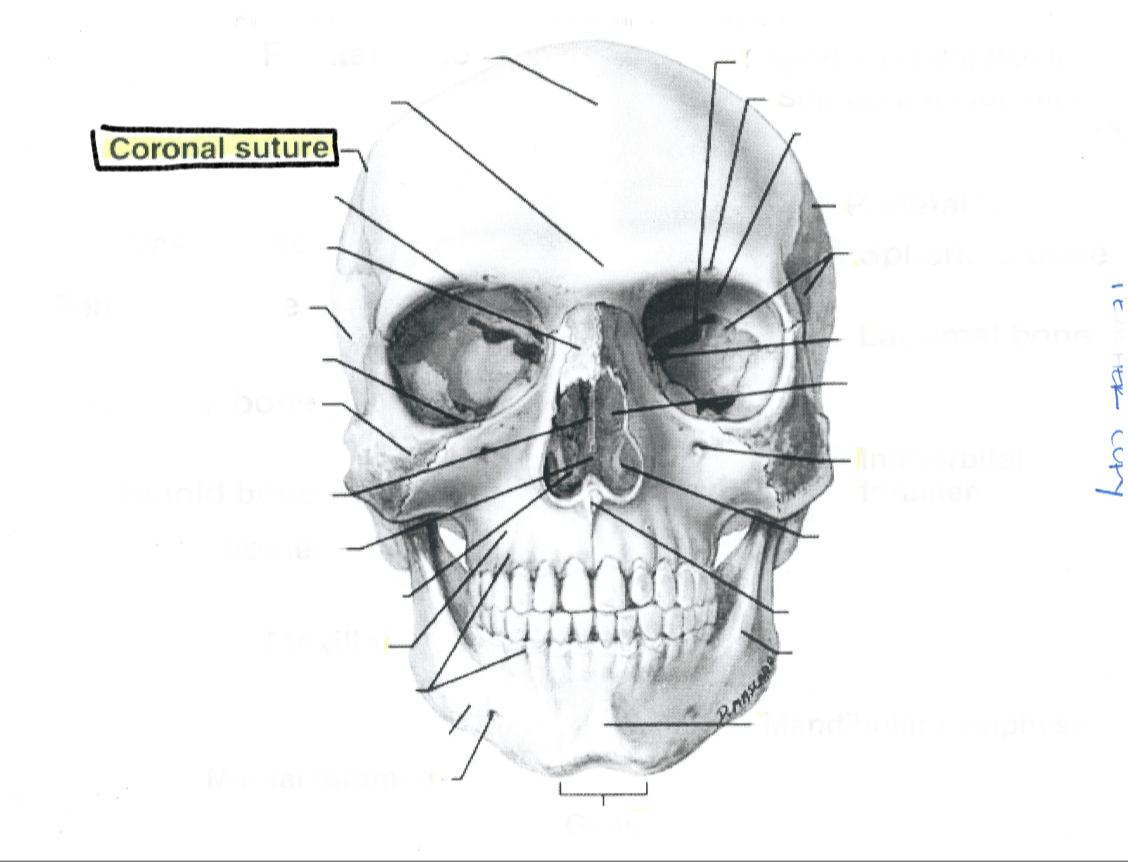 <p>Coronal suture</p>