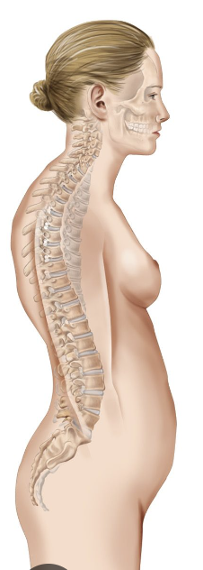 An exaggerated, forward rounding of the upper back. Also known as hunchback.
