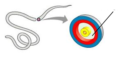 <p>a condition where an organisms possesses a body cavity that’s located between the mesoderm &amp; endoderm</p>