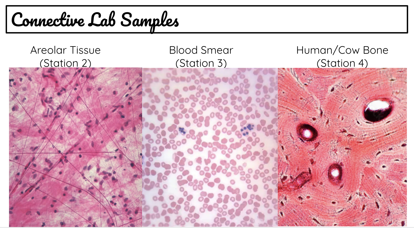 <ul><li><p><span>Dense Connective (tendons and ligaments)</span></p></li><li><p><span>Loose Connective (adipose and areolar → “loose connective tissue” + lots of collagen and elastic fibers + acts as “packing material” surrounding and supporting organs and other tissues)</span></p></li><li><p><span>Bone</span></p></li><li><p><span>Blood</span></p></li><li><p><span>Cartilage</span></p></li></ul><p></p>