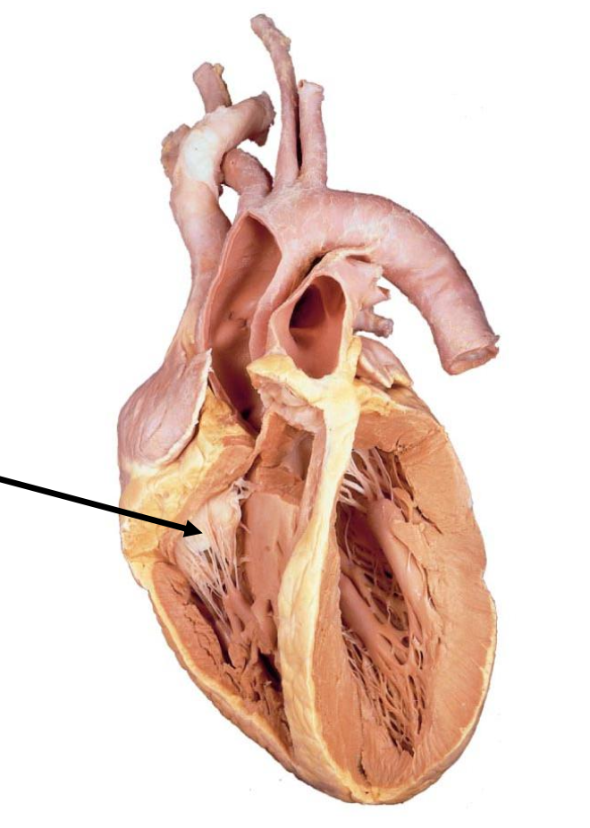 <p>What structure is the arrow pointing to?</p><p></p><p>a. Papillary muscle</p><p>b. Tricuspid valve</p><p>c. Auricle</p><p>D. Aorta</p>