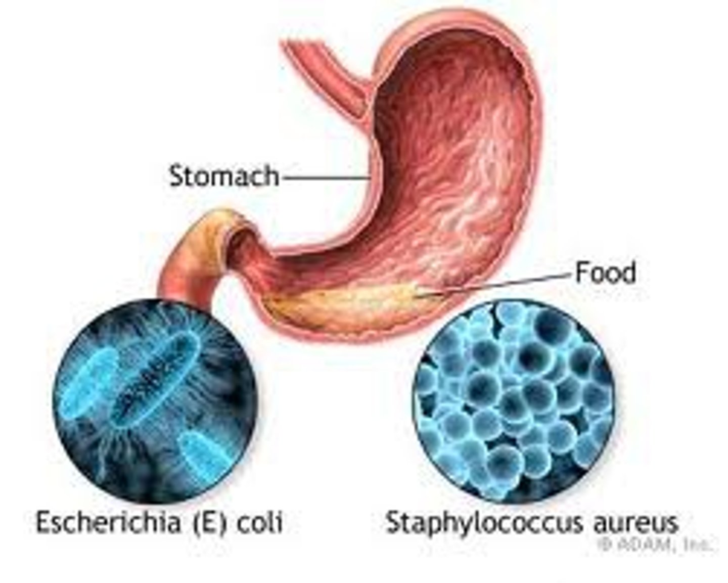 <p>exotoxin in gastrointestinal tract.</p><p>intoxication of foodborne illness, food inoculated with staphylococcus at room temperature allows for multiplication and production of enterotoxin. after vomiting toxin leaves.</p>