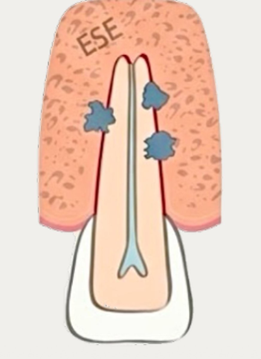 <p>Which type of resorption?</p>