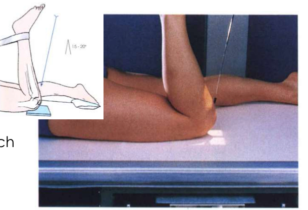 <p>PATELLA AND</p><p>PATELLOFEMORAL</p><p>JOINT</p>