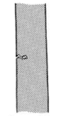 <p>What classification of fracture is this?</p>