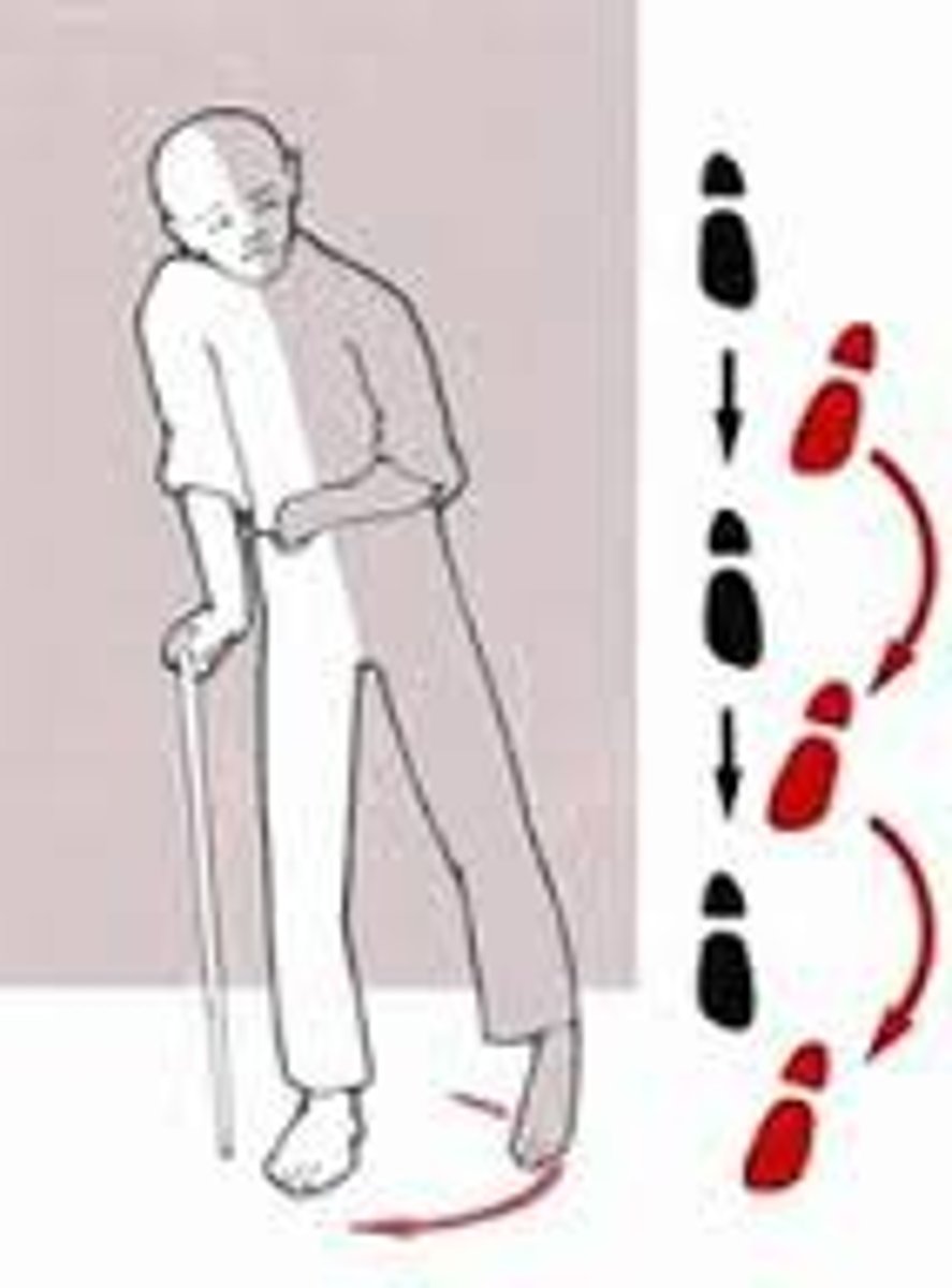 <p>Weakness will decrease ROM of the same motion in gait</p><p>Example: Weakness of hip flexors will cause decreased hip flexion and decrease step length on the same side</p>