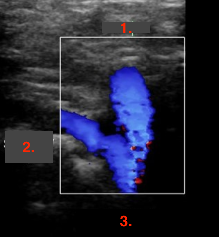 <p>Identify this image. </p>