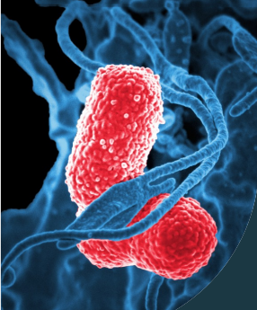 <p>Klebsiella pneumoniae</p>