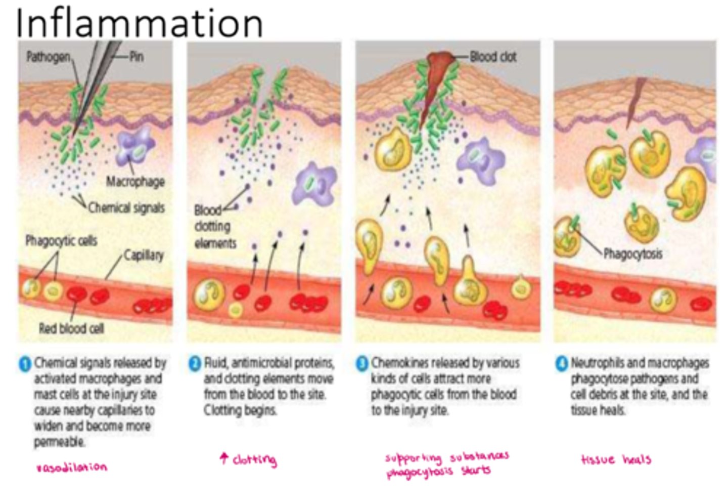 <p>- endothelial cells, mast cells, inflammatory mediators; macrophages</p><p>- other WBC &amp; chemotaxis; pro-inflammatory mediators; platelets</p><p>- fever</p>