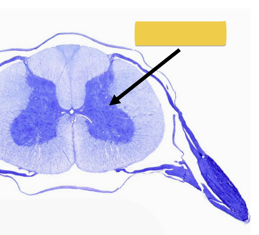 <ul><li><p>contains unmyelinated cell bodies of neurons</p></li><li><p>forms&nbsp;“butterfly” shaped regions</p></li><li><p>no myelin → gray color</p></li></ul><p></p>