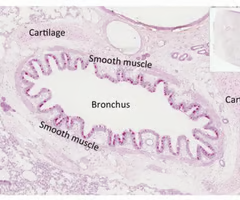 <p>Pseudostratified columnar epithelium --&gt; simple columnar cells</p><p>Irregular cartilage plates</p><p>Fewer seromucous glands</p><p>Smooth muscle is prominent </p><p>Has abundant elastic fibers</p>