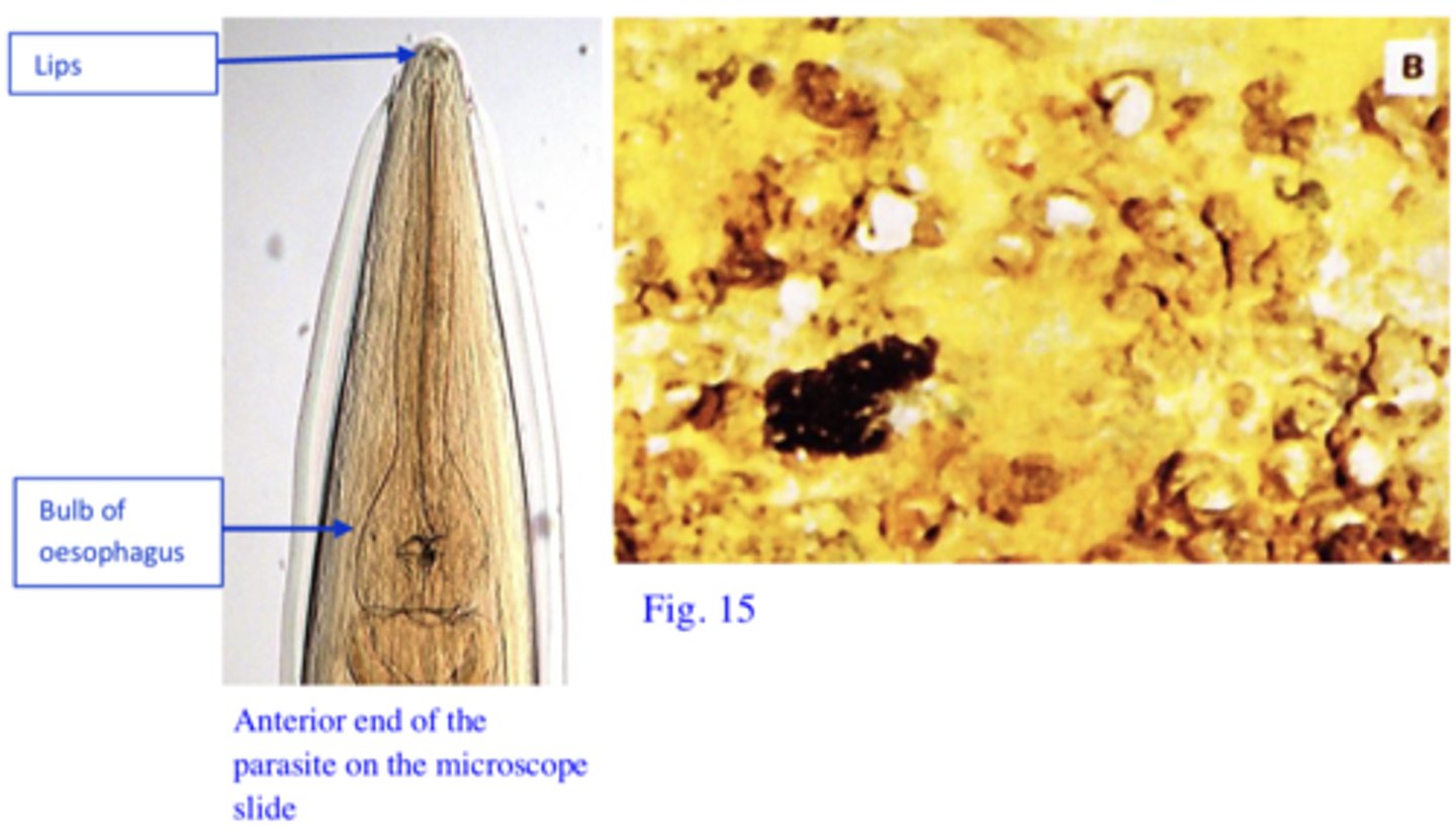 <p>Station 9:</p><p>The parasites on the microscope slide were found in the caeca of young poultry that were shedding bloody faeces. The farmer is rearing on his farm both poultry and turkey but the turkeys are showing more severe clinical signs: diarrhoea with yellow faeces (Fig. 15),drowsiness, dropping of the wings, closed eyes, emaciation etc. High percentage mortality occurred in the turkeys.</p>