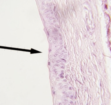 <p>what type of tissue is this </p>
