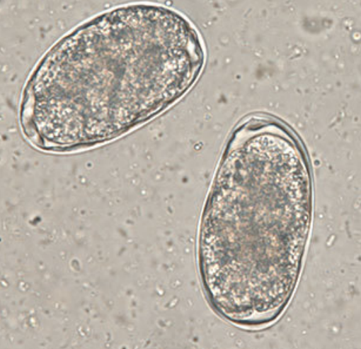 <p>What parasite egg is this?&nbsp;</p>