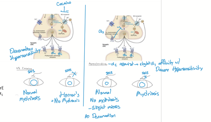 <ul><li><p>4% Cocaine: blocks reuptake; Normal = mydriasis; Horner’s = No Mydriasis</p></li><li><p>Apraclonidine (better test); Normal = slight miosis; Horner’s = Mydriasis</p></li></ul><p></p>