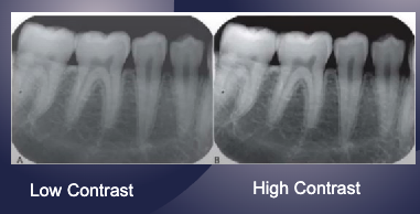 <p>contrast</p>