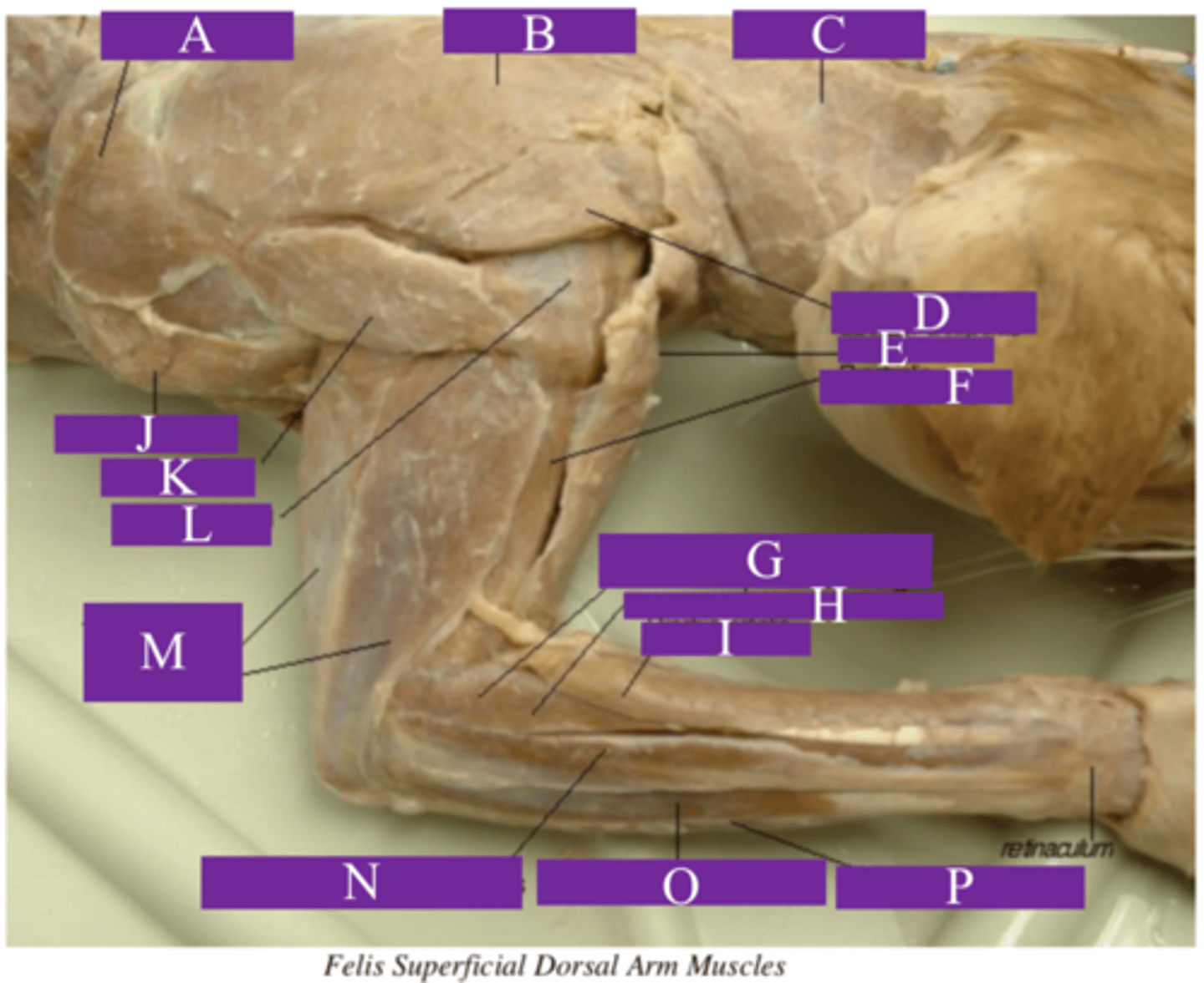 <p>What is letter N?</p>