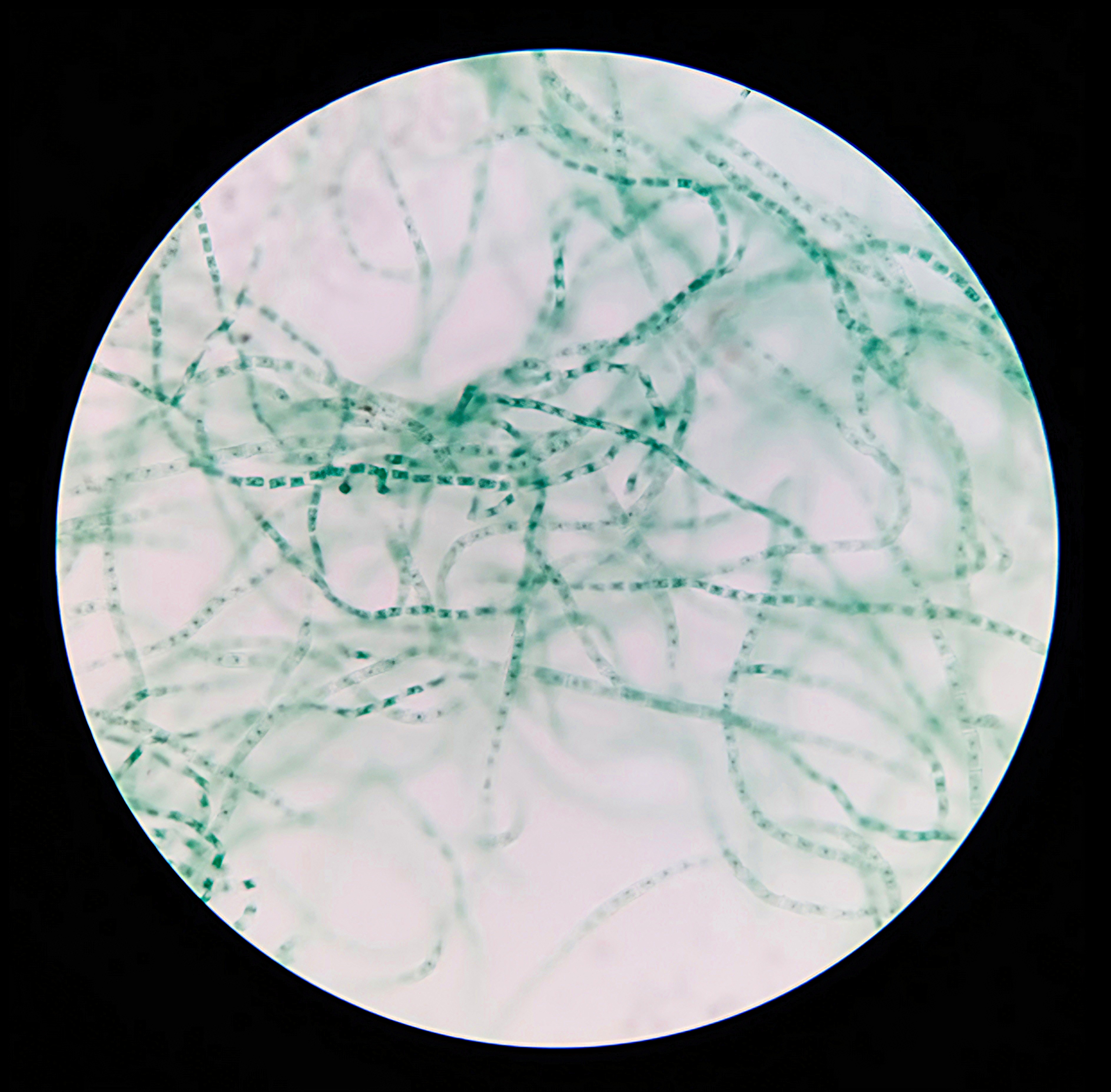 <p>Phylum: Chlorophyta</p><p>Ecological: Contributes to the production or conversion of carbon dioxide to oxygen through photosynthesis.</p><p>Medical: Research have found it has antifungal properties especially against <em>Aspergillus niger</em> (can cause pneumonia)</p>