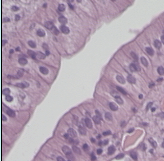 <p>epithelial tissue</p>