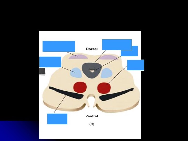 <p>what is the red thing </p>