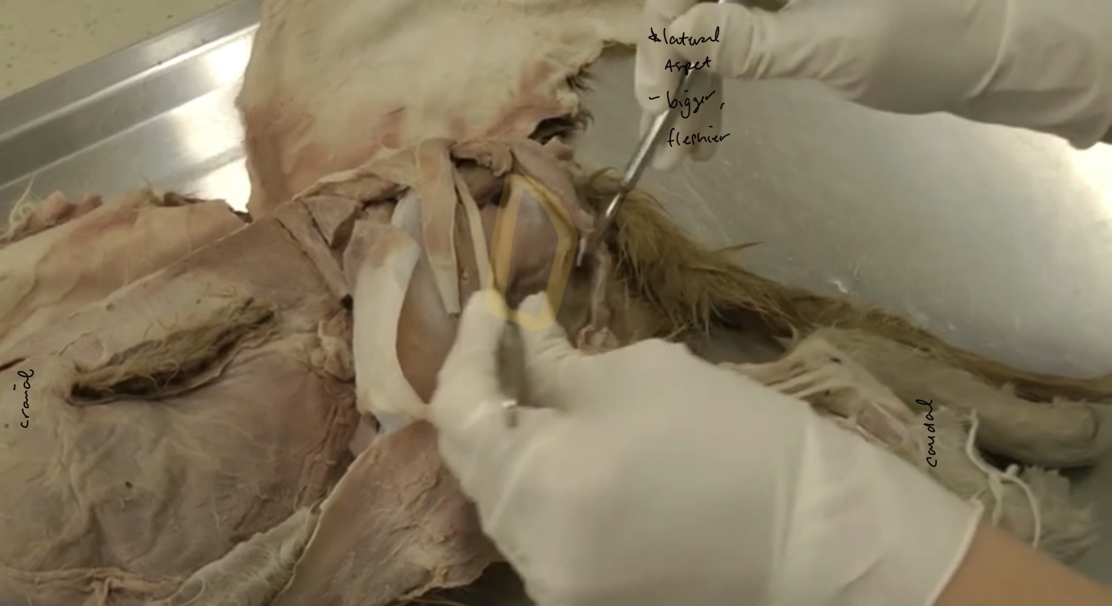 <p>What is the yellow highlighted muscle?</p>