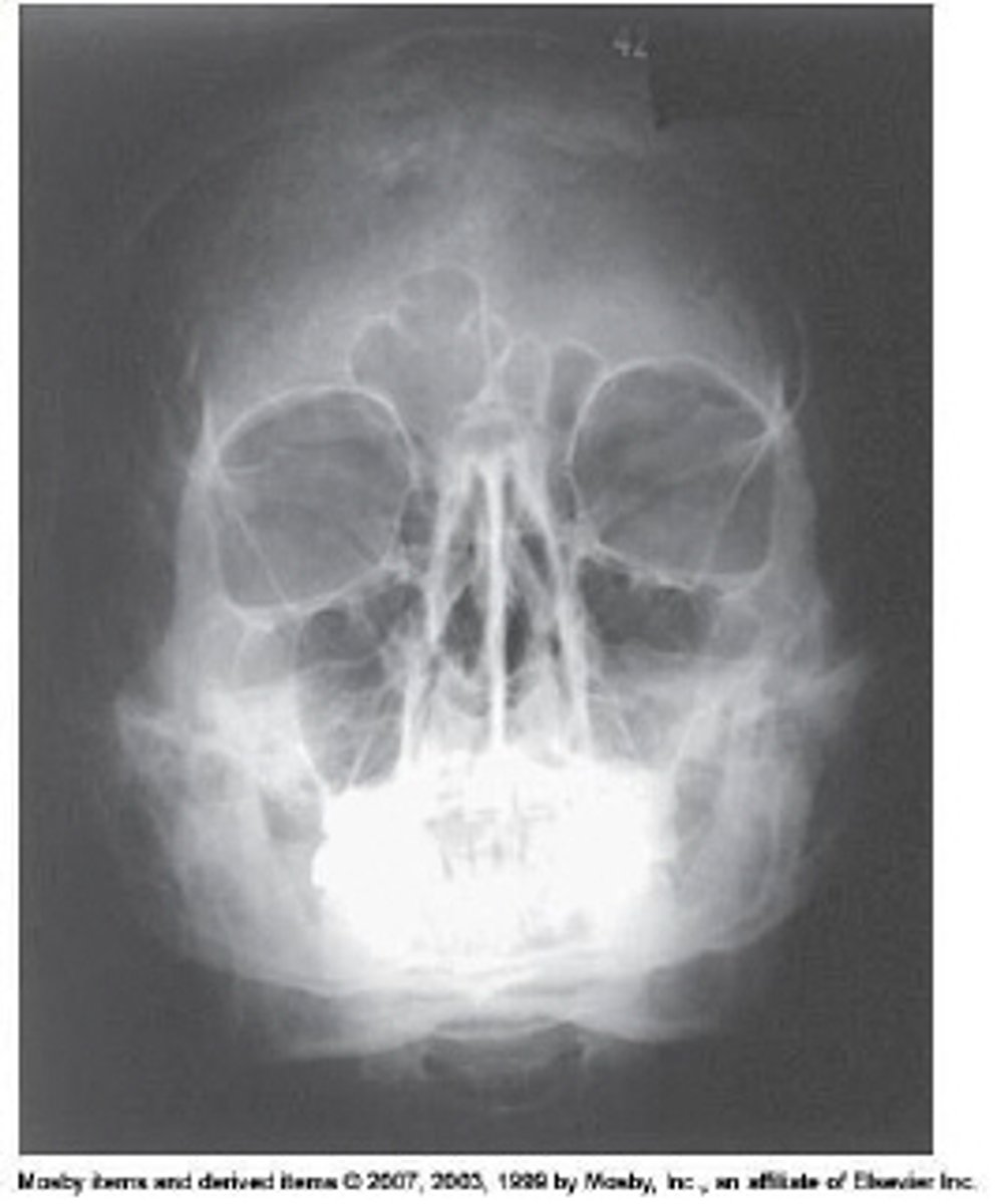 <p>What projection and method is demonstrated?</p>