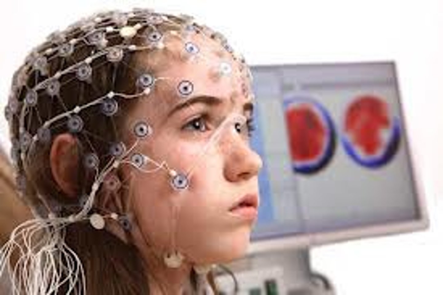 <p>Involves recording the electrical activity of the brain via electrodes on the scalp.</p>