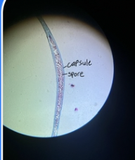 <p><span><strong><em>Anthoceros </em></strong>sporophyte</span></p>