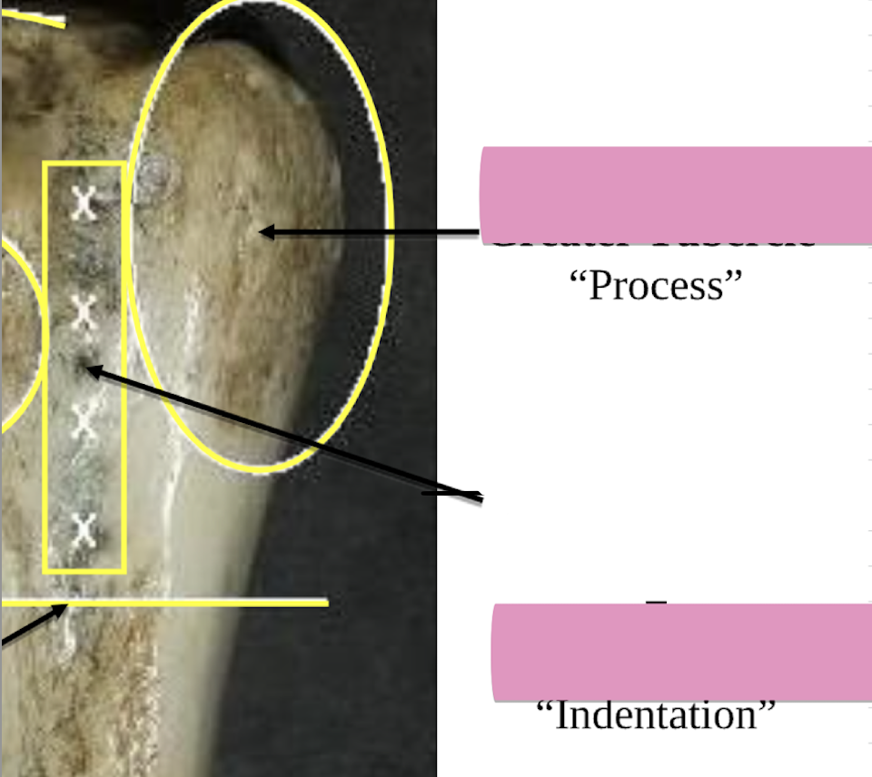 <p>Name the indentation </p>