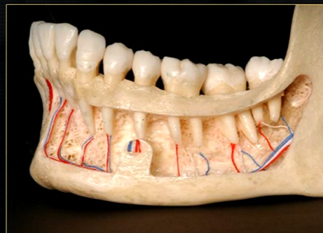 <p>left hand side of the mandible buccal surface has been removed </p>