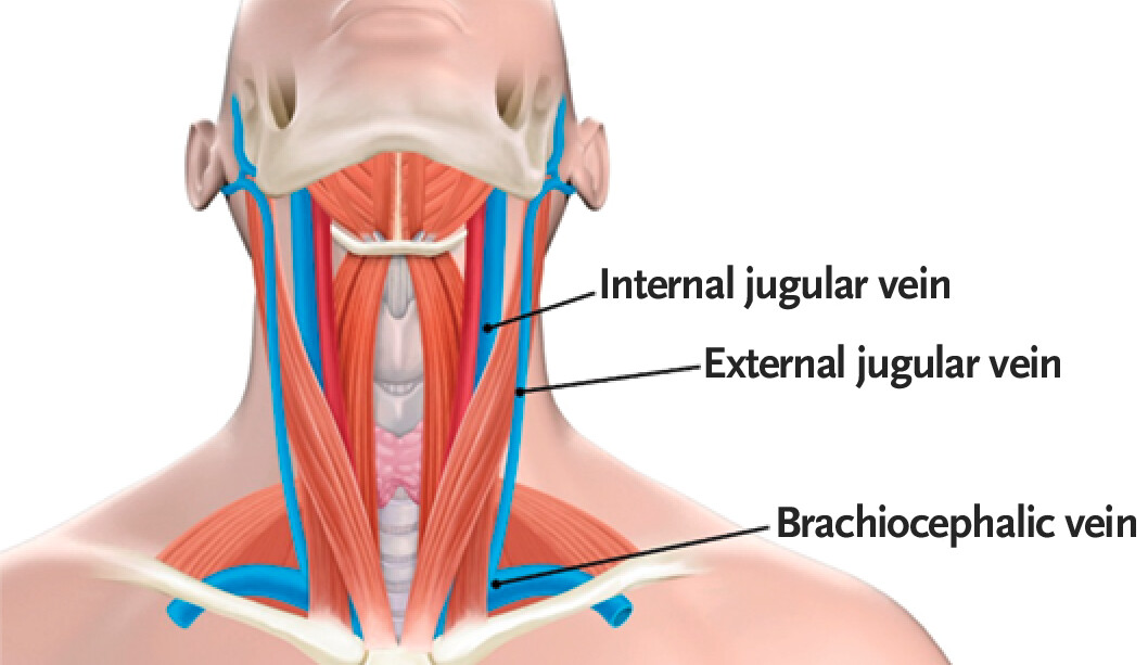 <p>a large, deep, vein located in the neck; runs along the lateral border of the common carotid artery and vagus nerve within the carotid sheath, joins with the subclavian vein to form the superior vena cava</p>