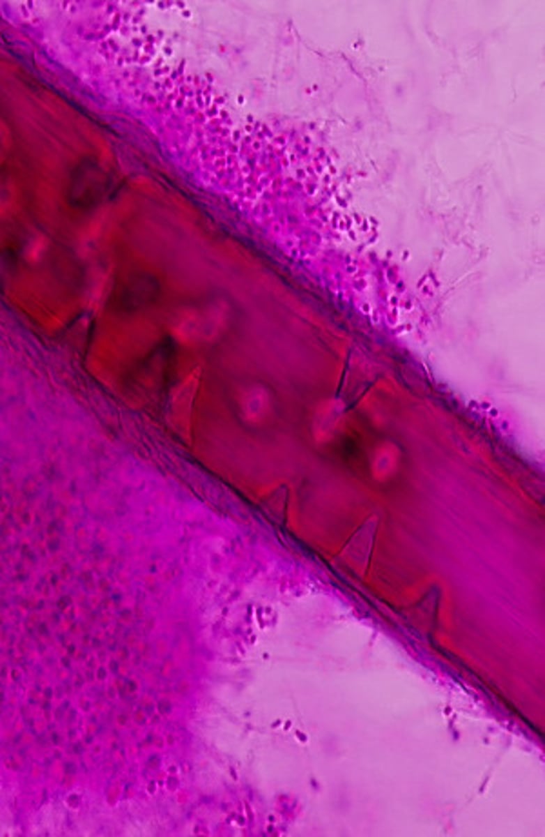 <p>Trichophyton mentagrophytes produces hyphal structures that invade hair shafts forming cone-shaped perforations. This is a useful test to differentiate dermatophytes.</p>