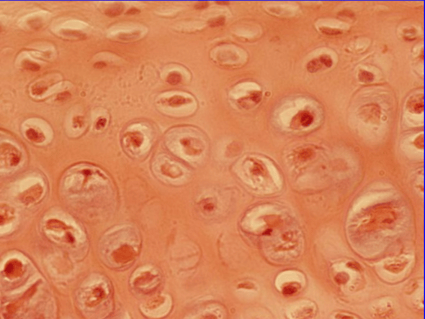 <p>Cell type: chondrocytes</p><p>Function: cushioning, support, reinforcement</p><p>Location: found on theends of long bones, ribs, trache</p><p>Matrix: relatively uniform</p>