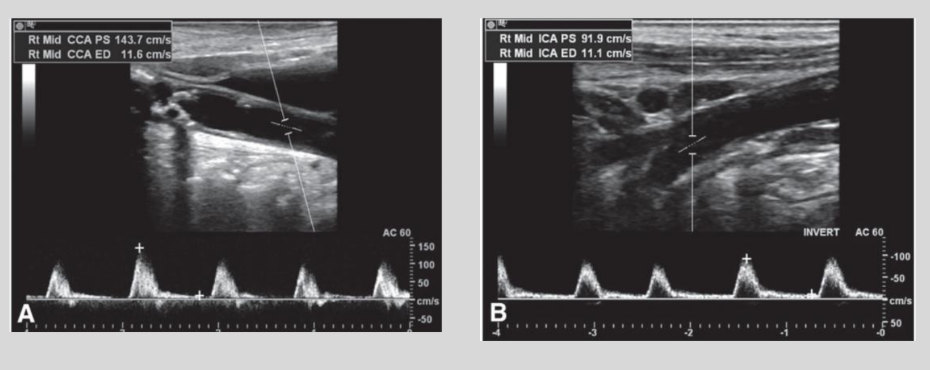 <p>what is this waveform showing?</p>