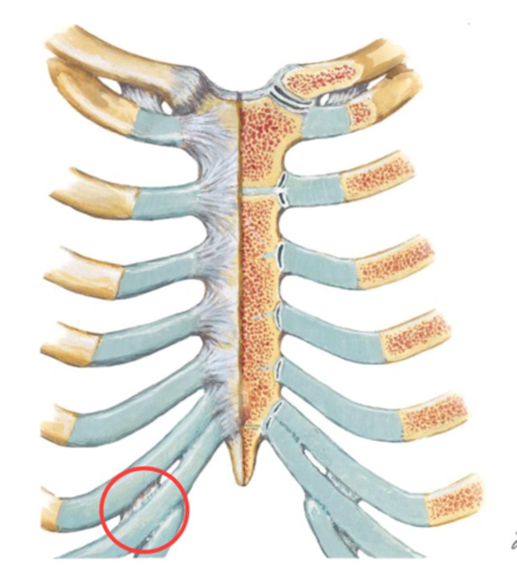 <p>synovial plane (diarthrosis arthrodial ) joint</p><p>anterior/posterior interchondral ligaments</p>