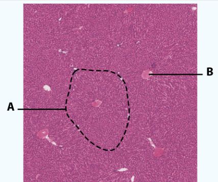 <p>B</p>