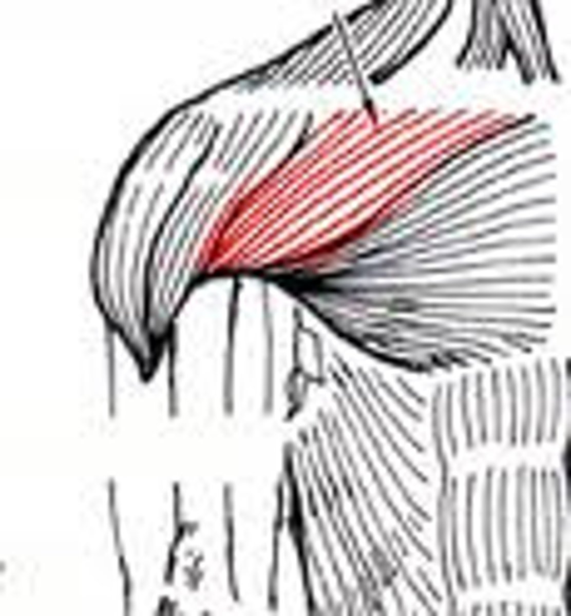 <p>arm underhand motions *bowling (medial half of inferior edge of clavicle)</p>