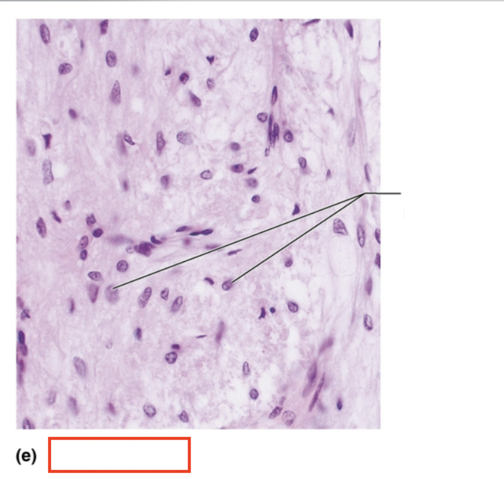 <p>What tissue is shown?</p>