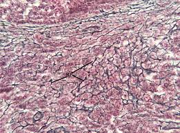 <p>What tissue is this</p>