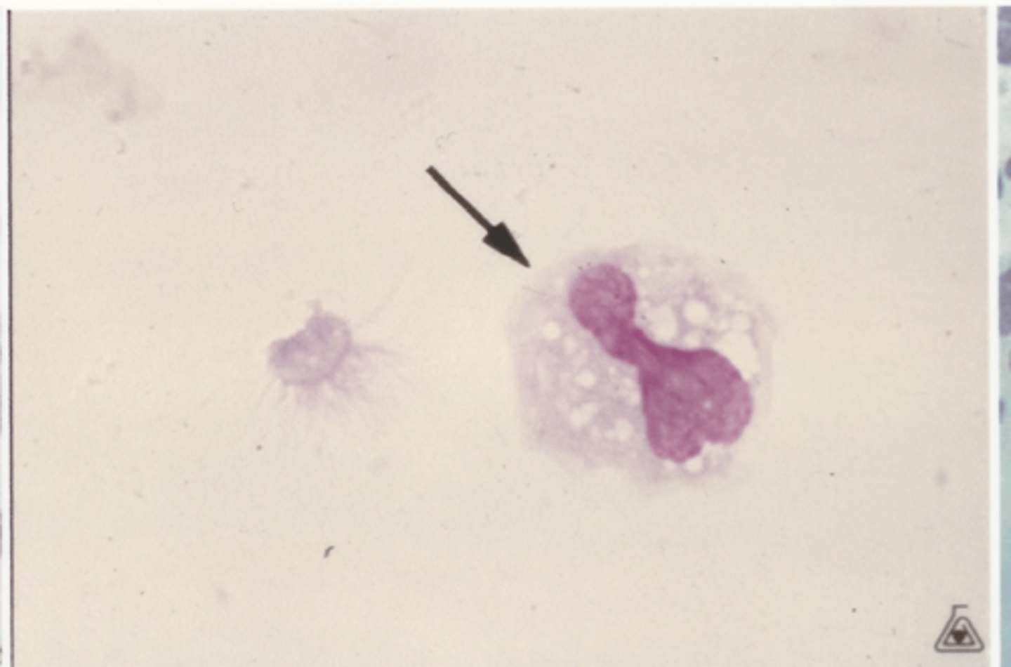 <p>Identify the cells in this body fluid</p>