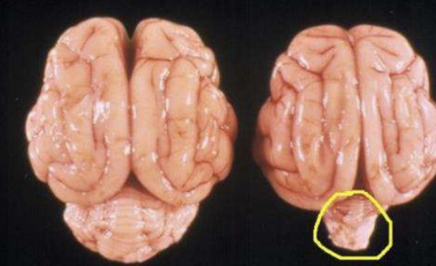 <p>feline ataxia occurs when a relatively avirulent strain of _________ disrupts cerebellar development by targeting and destroying rapidly dividing cells in late gestation into early neonatal life<br><br>a) Feline Calicivirus <br>b) Feline Viral Rhinotracheitis<br>c) Feline Panleukopenia<br>d) FIV<br>e) Feline Coronavirus</p>