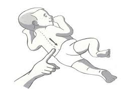<p>What is this reflex? </p>