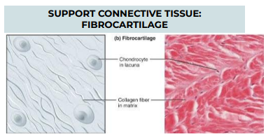 <p>TISSUE: SUPPORT CONNECTIVE TISSUE: FIBROCARTILAGE</p>