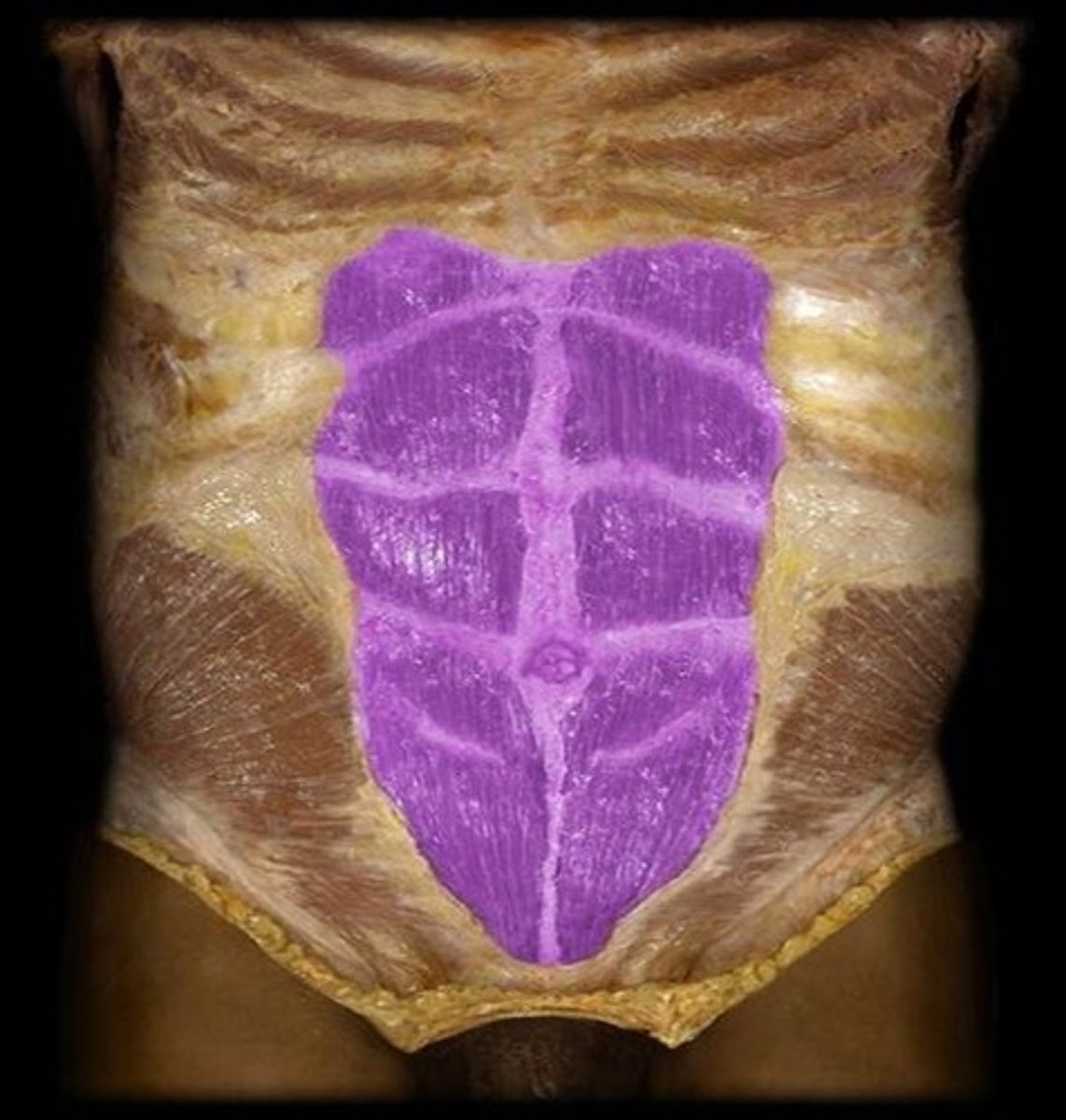 <p>What is the name of this muscle, highlighted in purple?</p>