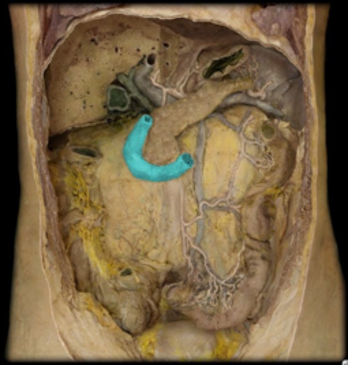 <p>Identify this portion of the small intestine.</p>