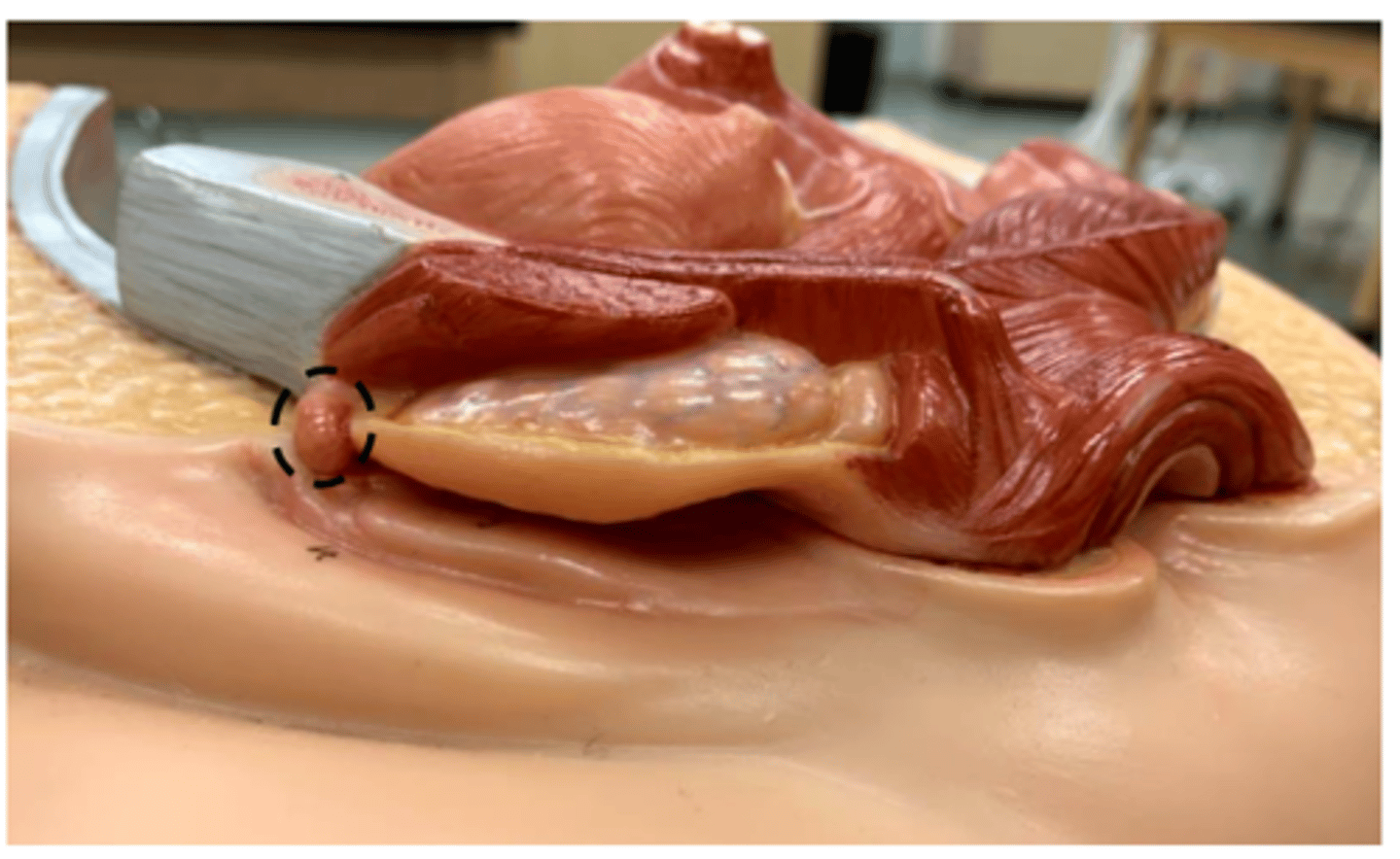 <p>red small gland</p>