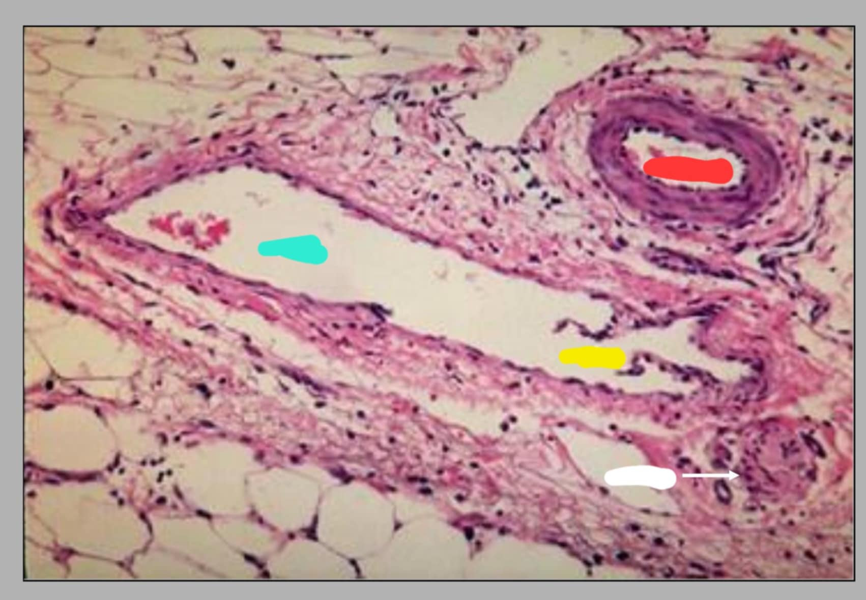 <p>name this slide and state its parts</p>